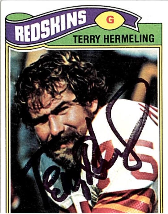 Terry Hermeling - Washington Redskins